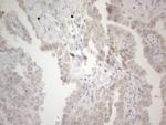 PD-L2 (PDCD1LG2) Antibody in Immunohistochemistry (Paraffin) (IHC (P))