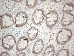 PD-L2 (PDCD1LG2) Antibody in Immunohistochemistry (Paraffin) (IHC (P))