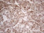 PD-L2 (PDCD1LG2) Antibody in Immunohistochemistry (Paraffin) (IHC (P))