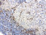 PDCD1 Antibody in Immunohistochemistry (Paraffin) (IHC (P))