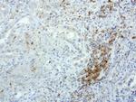 PDCD1 Antibody in Immunohistochemistry (Paraffin) (IHC (P))