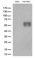 PDCD1 Antibody in Western Blot (WB)