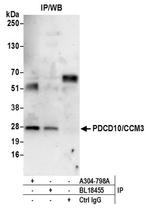 PDCD10/CCM3 Antibody in Immunoprecipitation (IP)