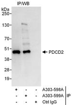 PDCD2 Antibody in Immunoprecipitation (IP)