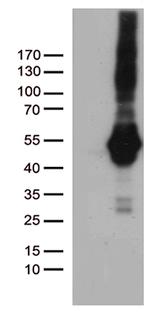 PDCD2L Antibody in Western Blot (WB)