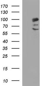 PDCD6IP Antibody in Western Blot (WB)