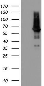 PDE1A Antibody in Western Blot (WB)