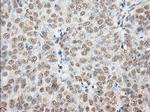 PDE4A Antibody in Immunohistochemistry (Paraffin) (IHC (P))