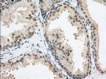 PDE4A Antibody in Immunohistochemistry (Paraffin) (IHC (P))