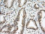 PDE4A Antibody in Immunohistochemistry (Paraffin) (IHC (P))