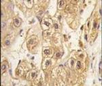 PDGFRB Antibody in Immunohistochemistry (IHC)