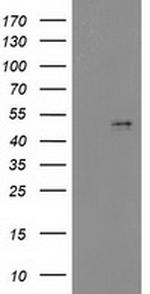 PDGFD Antibody in Western Blot (WB)