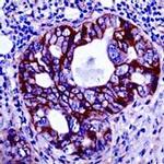 PDGFRB Antibody in Immunohistochemistry (IHC)