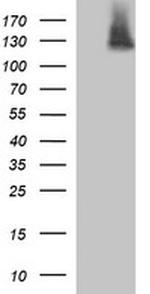 PDGFRB Antibody in Western Blot (WB)