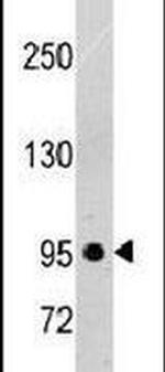 PDGFRB Antibody in Western Blot (WB)