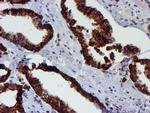 PDIA4 Antibody in Immunohistochemistry (Paraffin) (IHC (P))