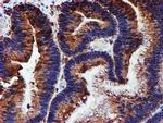 PDIA4 Antibody in Immunohistochemistry (Paraffin) (IHC (P))