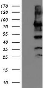 PDIA4 Antibody in Western Blot (WB)