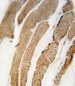 PDK4 Antibody in Immunohistochemistry (IHC)