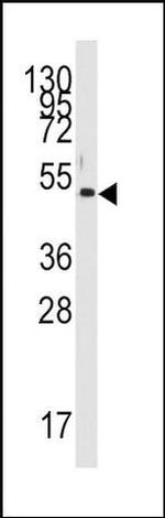 PDK4 Antibody in Western Blot (WB)