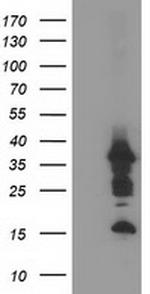 PDLIM2 Antibody in Western Blot (WB)