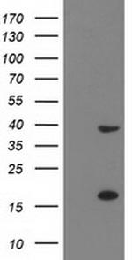 PDLIM2 Antibody in Western Blot (WB)