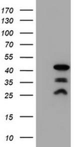 PDLIM2 Antibody in Western Blot (WB)