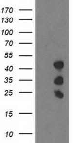 PDLIM2 Antibody in Western Blot (WB)