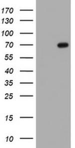 PDLIM5 Antibody in Western Blot (WB)