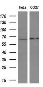 PDLIM5 Antibody in Western Blot (WB)