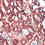 IGF2 Antibody in Immunohistochemistry (IHC)