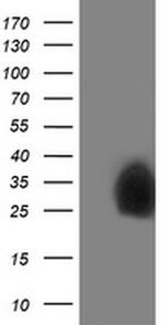 PDXK Antibody in Western Blot (WB)