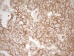 PELI1 Antibody in Immunohistochemistry (Paraffin) (IHC (P))