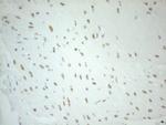 PELI1 Antibody in Immunohistochemistry (Paraffin) (IHC (P))