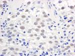 PELP1/MNAR Antibody in Immunohistochemistry (IHC)