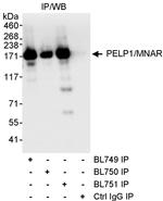 PELP1/MNAR Antibody in Immunoprecipitation (IP)