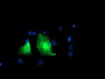 PFKP Antibody in Immunocytochemistry (ICC/IF)