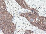 PFKP Antibody in Immunohistochemistry (Paraffin) (IHC (P))