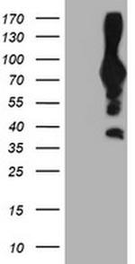 PFKP Antibody in Western Blot (WB)