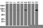 PFKP Antibody in Western Blot (WB)