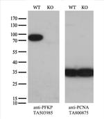 PFKP Antibody in Western Blot (WB)