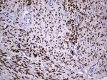 PGR Antibody in Immunohistochemistry (Paraffin) (IHC (P))