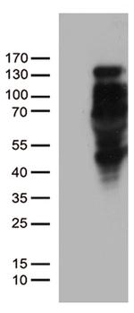 PGR Antibody in Western Blot (WB)