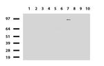 PGR Antibody in Western Blot (WB)