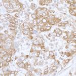 PGRMC1 Antibody in Immunohistochemistry (IHC)