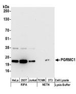 PGRMC1 Antibody in Western Blot (WB)