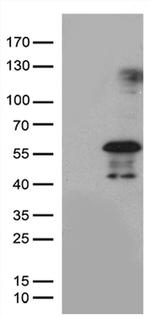 PHLDA1 Antibody in Western Blot (WB)