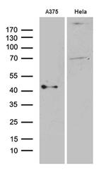 PHLDA1 Antibody in Western Blot (WB)