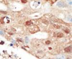 PIK3R2 Antibody in Immunohistochemistry (IHC)