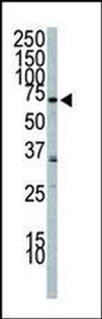 PIK3R2 Antibody in Western Blot (WB)